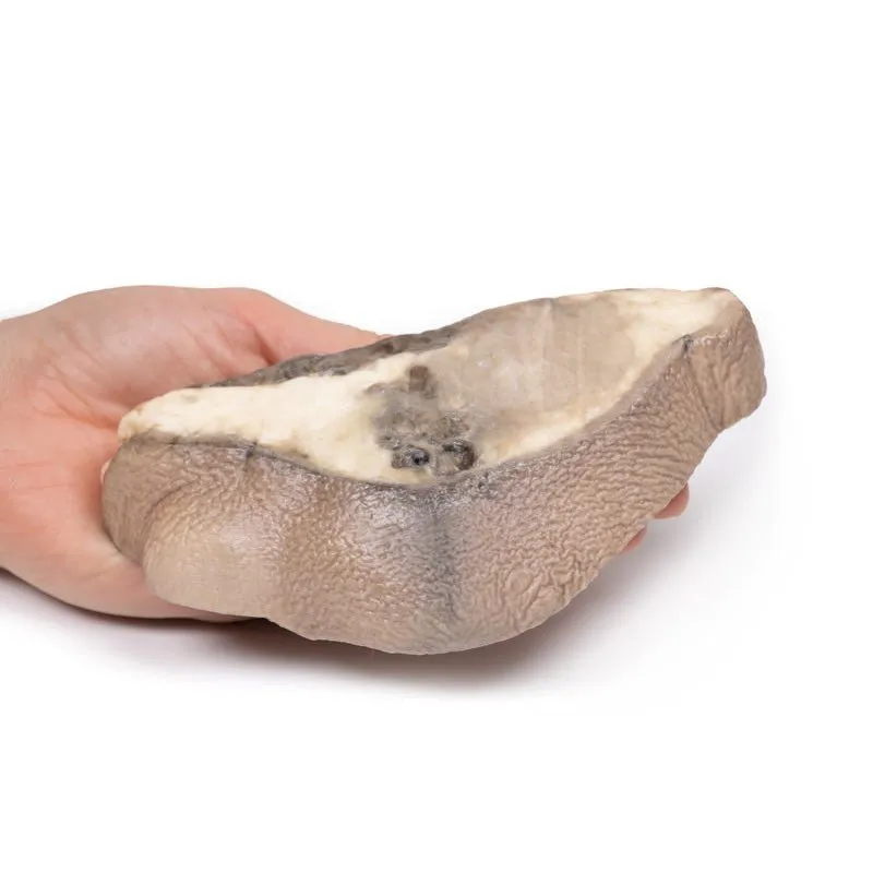 3D Printed Carcinoma of Breast