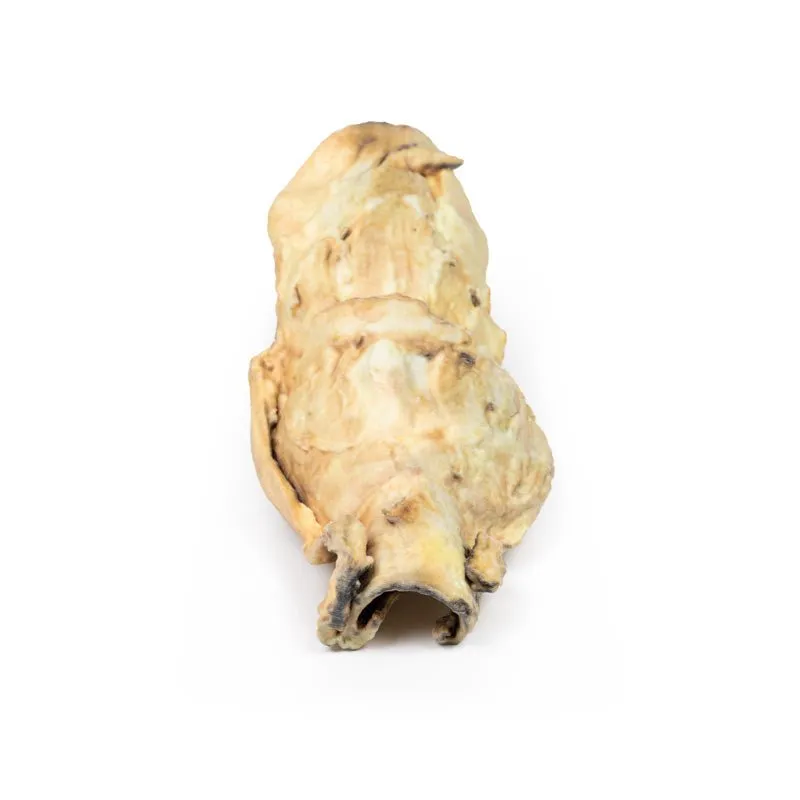 3D Printed Carcinoma of Larynx  with a 2 Months History of Dysphagia